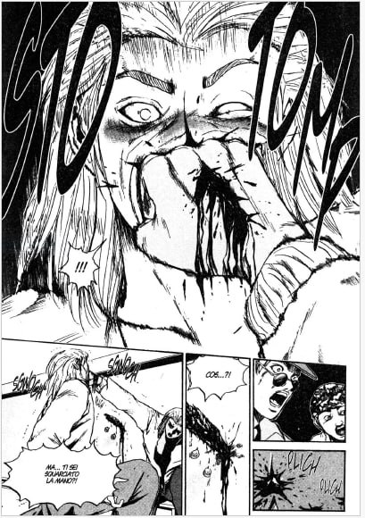 Ti Sei Squarciato La Mano